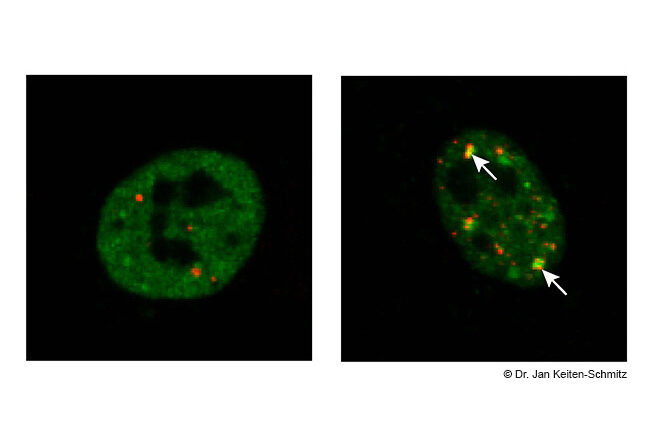 Zellreparatursystem könnte ALS-Proteinaggregation verhindern