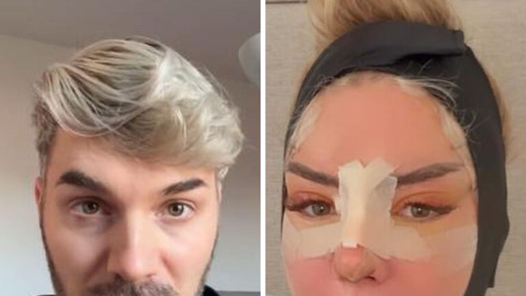 Sam Dylan mahnt Fans zu Emma Fernlunds Beauty-Eingriffen