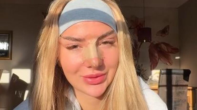 Emma Fernlund zu Beauty-OP: Fans nennen es fahrlässig
